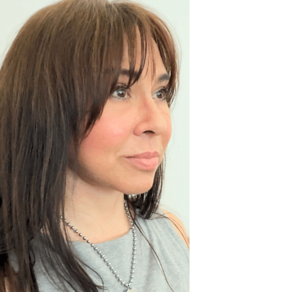 After Image: Facelift, necklift, upper blepharoplasty - right-front-oblique